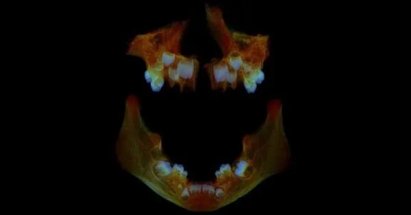 What Anglo Saxon teeth can tell us about modern health What Anglo Saxon teeth can tell us about modern health