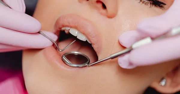 What Are the Most Common Dental Problems? What Are the Most Common Dental Problems?