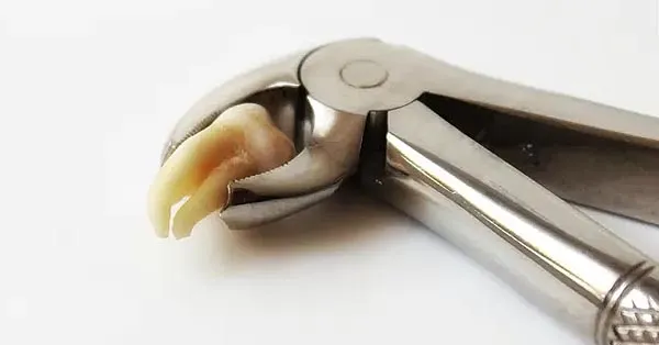 The Wise Patient’s Cheat Sheet on Wisdom Teeth Removal The Wise Patient’s Cheat Sheet on Wisdom Teeth Removal