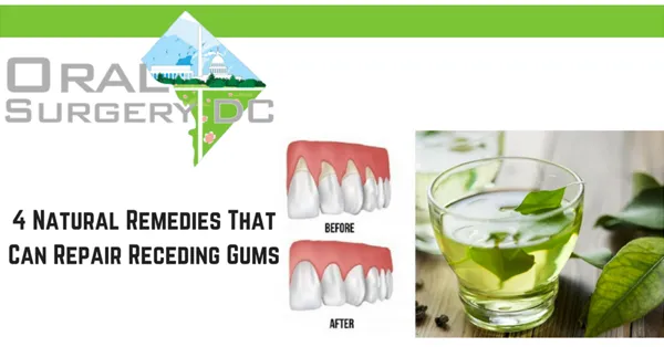 These 4 Natural Remedies Will Repair Receding Gums These 4 Natural Remedies Will Repair Receding Gums