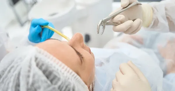 Top 5 Signs You Need Extraction of Wisdom Teeth in Largo Top 5 Signs You Need Extraction of Wisdom Teeth in Largo